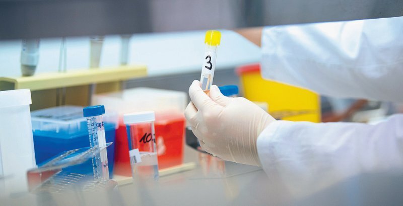 Alternativmedizin: Welche Kassen übernehmen die Kosten?
